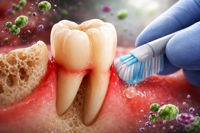 découvrez les causes d'une dent qui bouge, les signes à surveiller, les risques de chute dentaire et les méthodes efficaces pour préserver votre dentition.